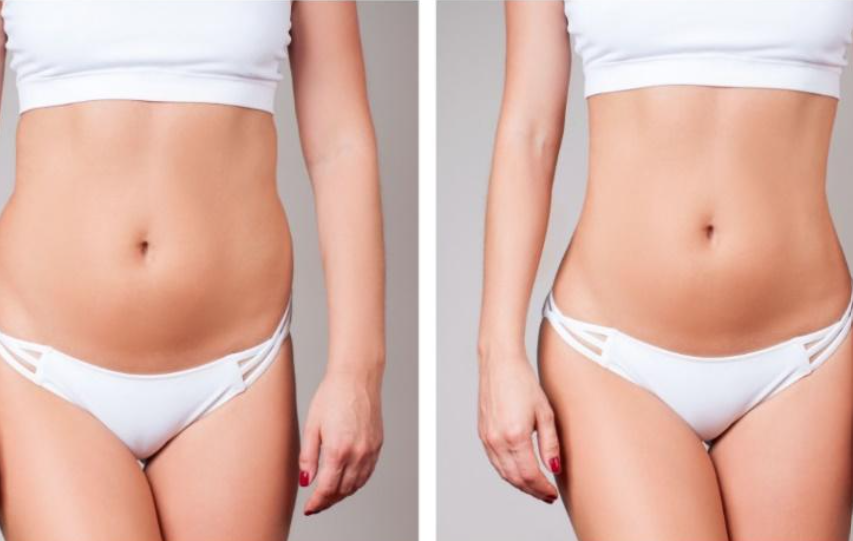 Imagem de resultados